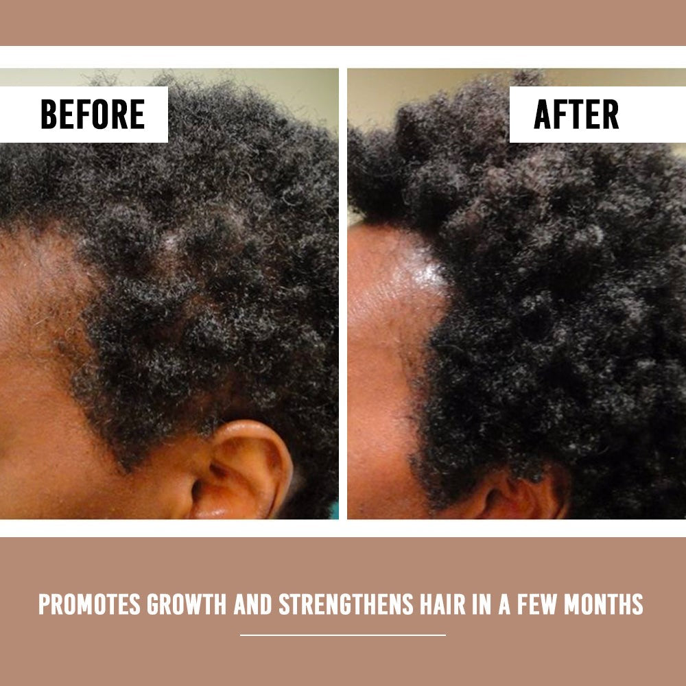 Hair Growth Set